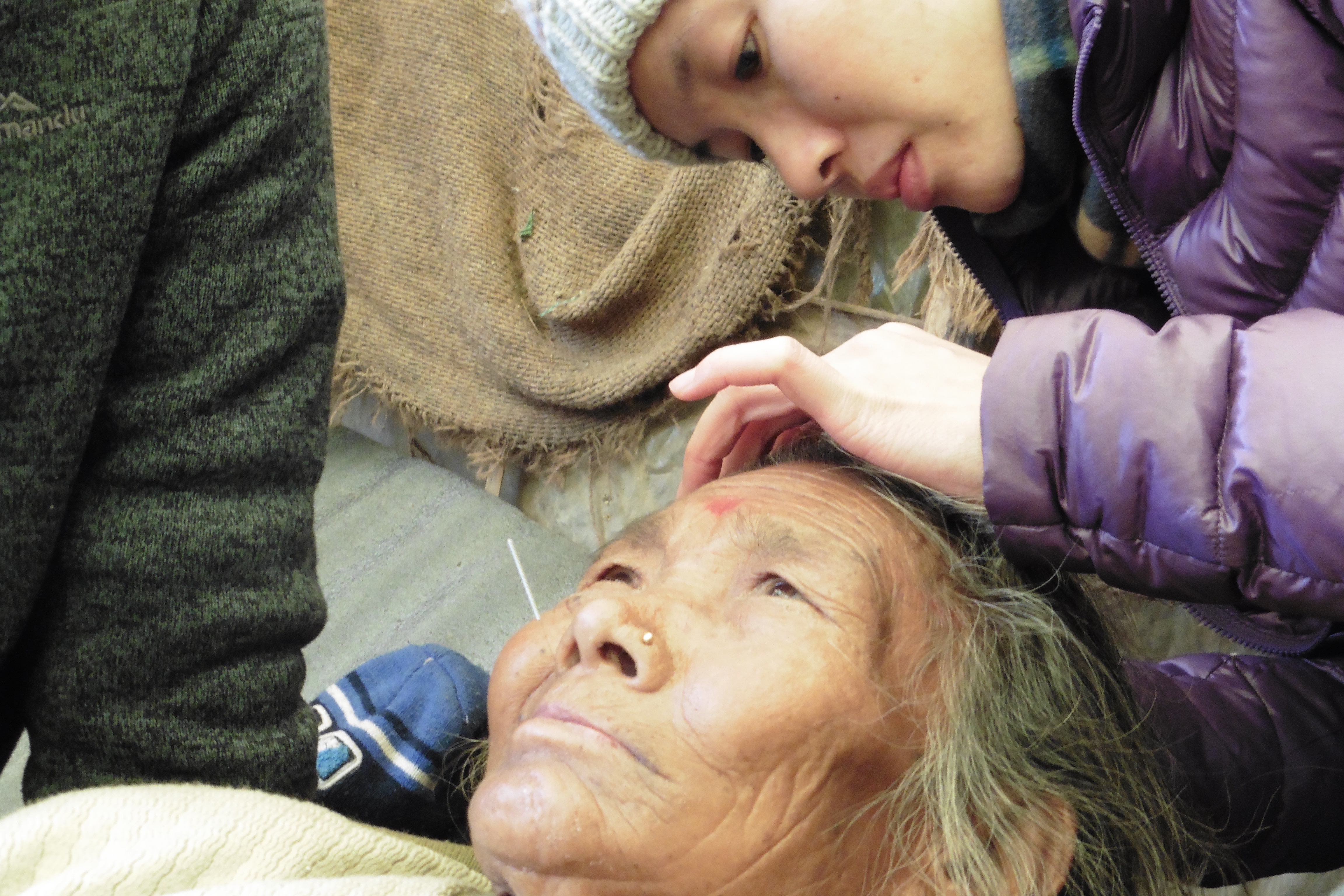 Photo of Rachel putting acupuncture needles on a patient